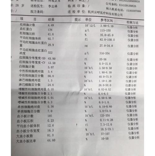 社交恐惧症最有效的治疗方法吃帕罗西西汀需要多久 社交焦虑吃帕罗西汀多久见效