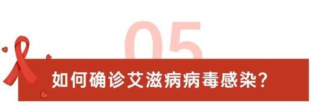 艾滋病能去国企上班吗 艾滋病能去国企上班吗女